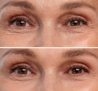 12 Pair Collagen 24K Gold Eye Mask Patches For Dark Circles, Puffy Eyes, & Eye Bags